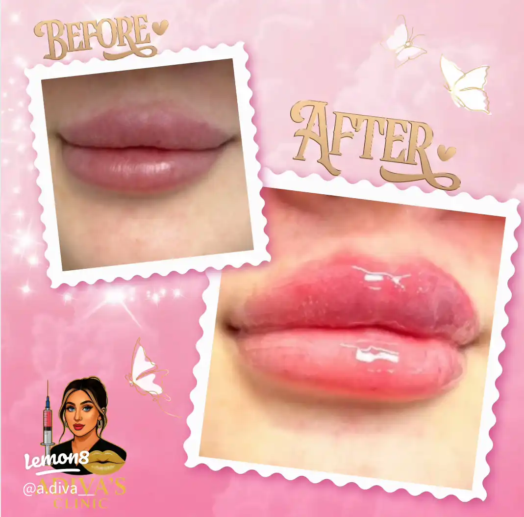 ONLY £80 1ML Russian or classic in Windsor 's images(1)